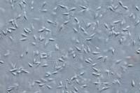 Spermatozoïdes d'Oursin x100